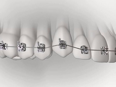 承德市哪家口腔醫(yī)院口腔正畸做得好？惟德口腔醫(yī)院來告訴您