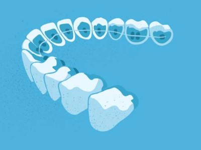 惟德口腔醫(yī)院口腔正畸好不好？